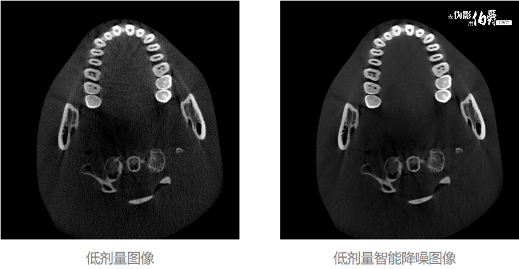 6-低剂量智能降噪.png