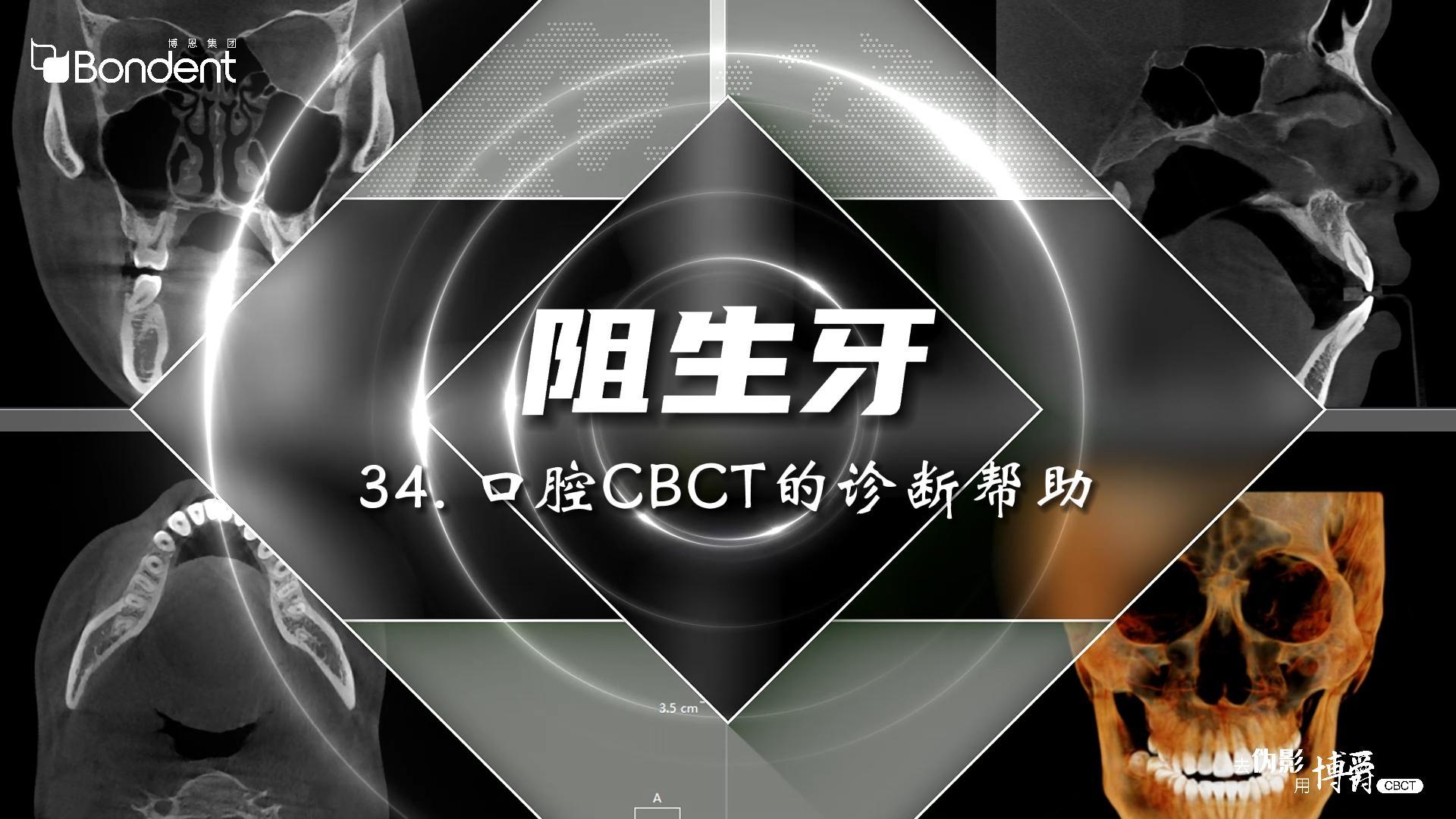 34-阻生牙-口腔CBCT的诊断帮助——博爵牙科CT口腔医学影像基础诊断