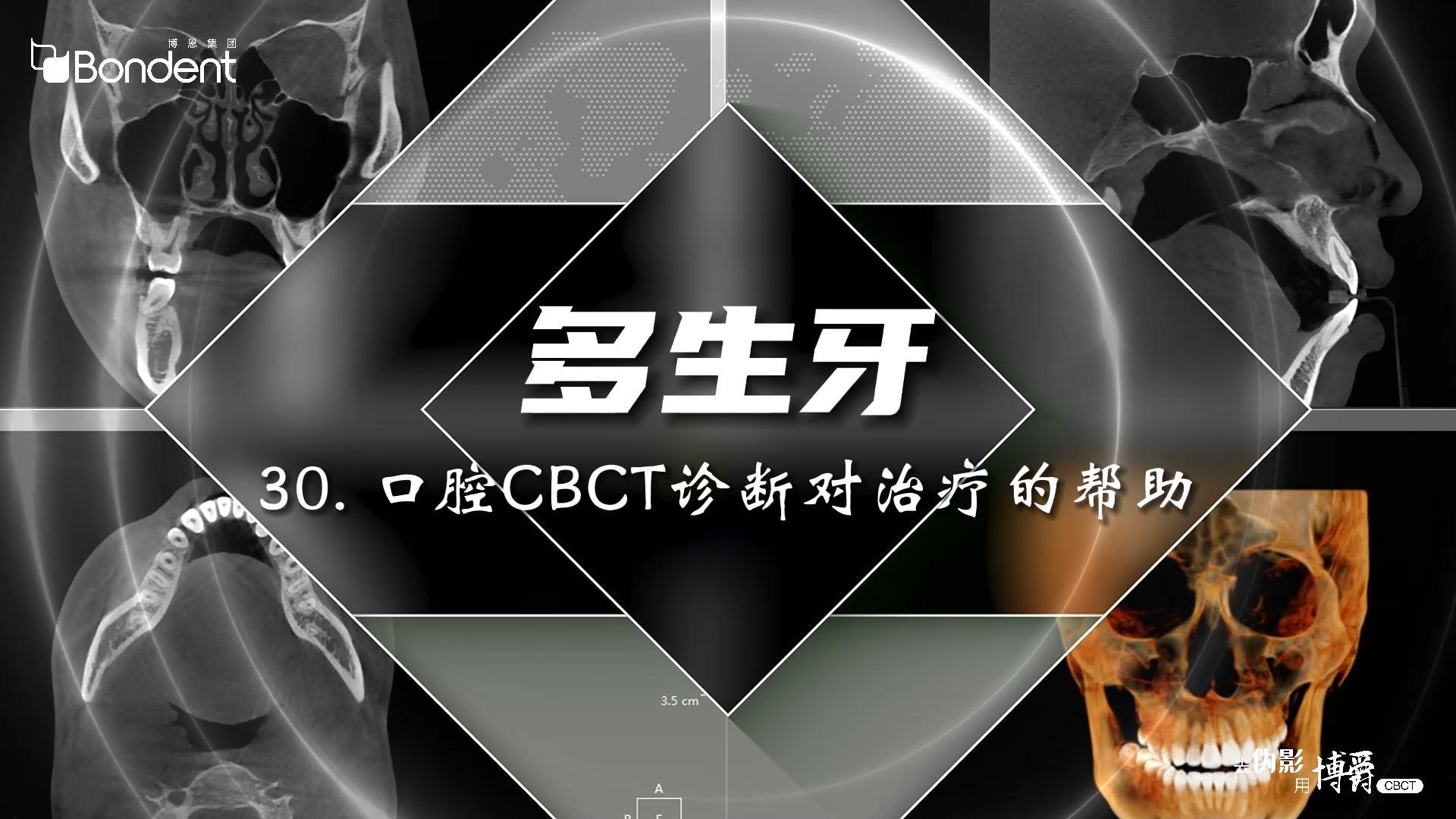 30-多生牙-口腔CBCT诊断对治疗的帮助——博爵牙科CT口腔医学影像基础诊断