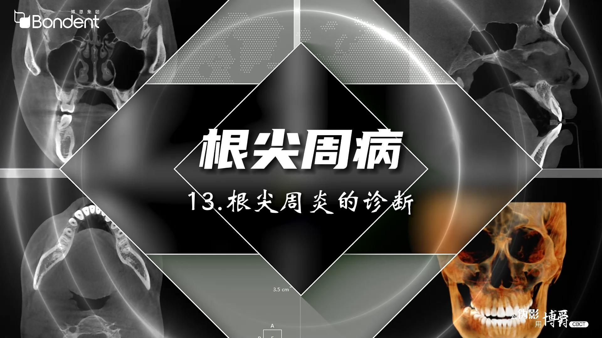 13-根尖周病-根尖周炎的诊断——博爵牙科CT口腔医学影像基础诊断