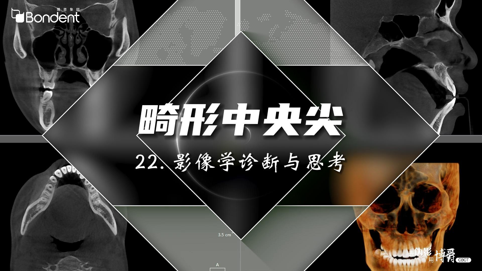 22-畸形中央尖-影像学诊断与思考——博爵牙科CT口腔医学影像基础诊断