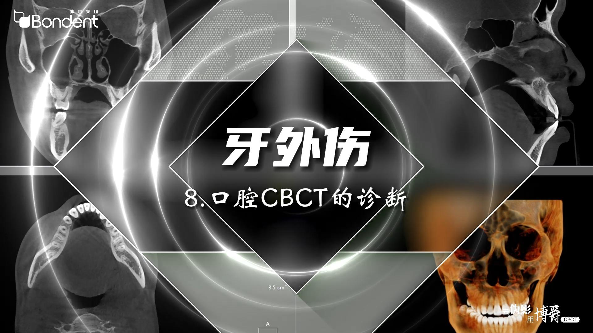 8-牙外伤-口腔CBCT诊断——博爵牙科CT口腔医学影像基础诊断