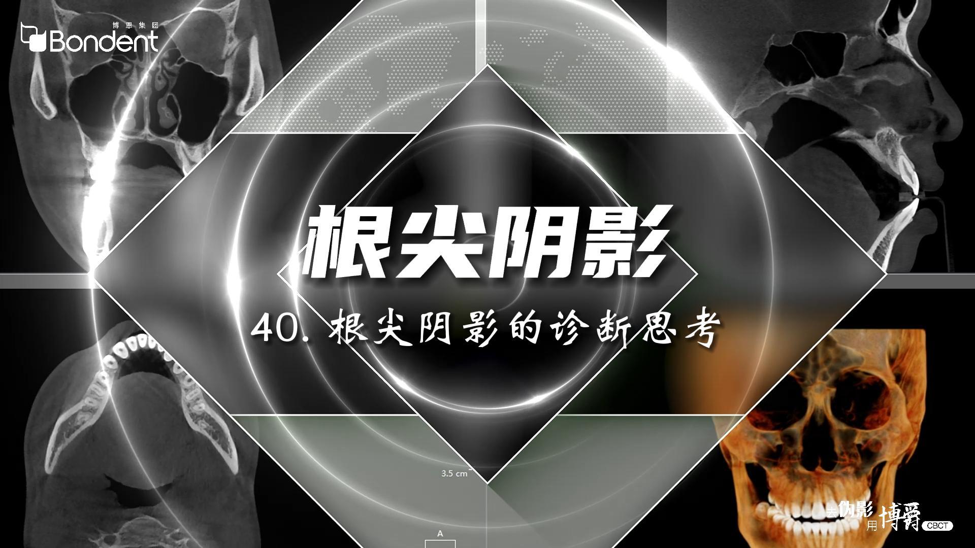 40-根尖阴影的诊断思考——博爵牙科CT口腔医学影像基础诊断