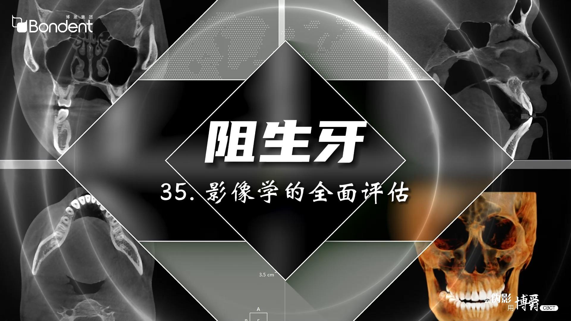 35-阻生牙-影像学的全面评估——博爵牙科CT口腔医学影像基础诊断