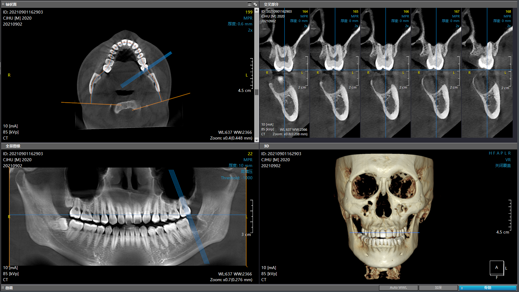 博爵CBCT 1030 X系列