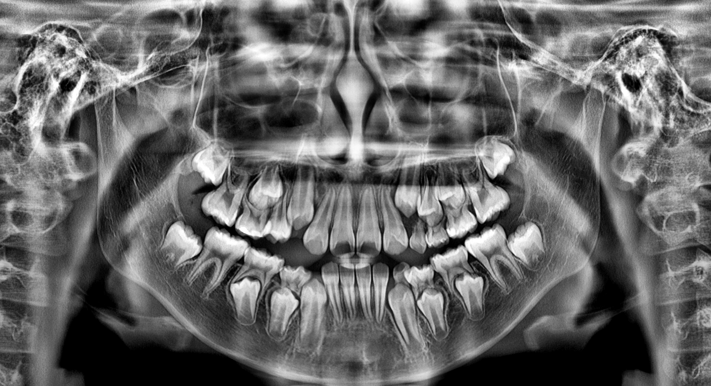 博爵CBCT 1030 X系列