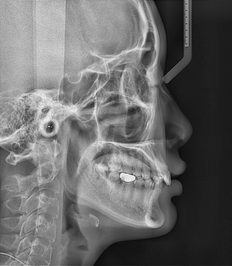 博爵CBCT 1030 X系列