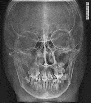 博爵1030XE坐式智能CBCT