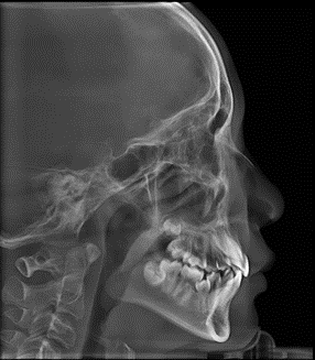 博爵1030XE坐式智能CBCT