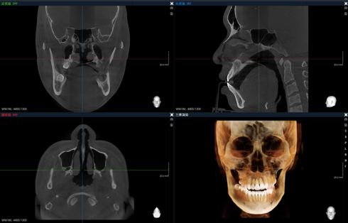 博爵1030XE坐式智能CBCT