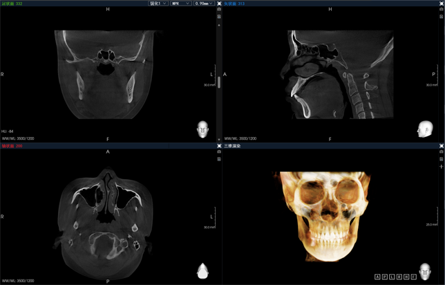 博爵CBCT 1030 X系列