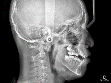 博爵云晰1070大视野智能口腔CBCT